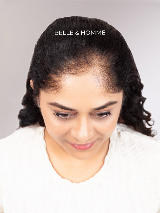 3"x 2" Front Coverage Seamless Hair Patch  - Curly